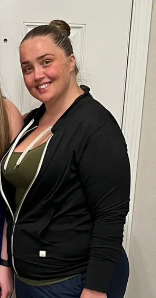 J., before and after twelve weeks — before